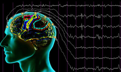 EEG Nedir?