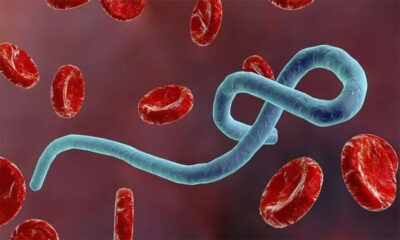 Ebola Virüsü Nedir? Belirtileri ve Tedavi Yöntemleri Nelerdir?