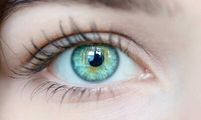 Göz Kanseri Nedir? Belirti ve Tedavi Yöntemleri Nelerdir?