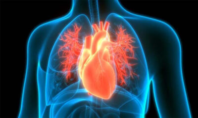 Kalp Romatizması Nedir? Kalp Romatizması Belirtileri Nelerdir?