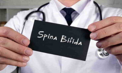 Spina Bifida Nedir? Belirtileri ve Tedavi Yöntemleri Nelerdir?