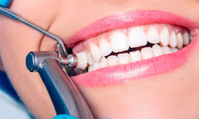 Diş Temizleme Nedir?