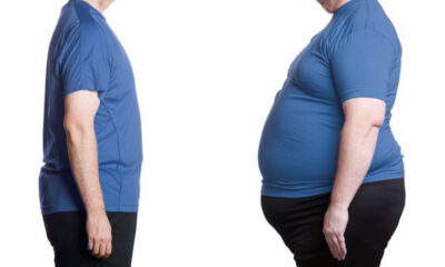 Obezitenin Nedenleri ve Sonuçları